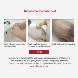 How to apply LANBENA Acne Scar Removal Cream product and buy from Shop&Shop