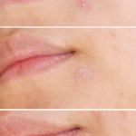 cosrx-acne-pimple-master-patch-shopandshop-5