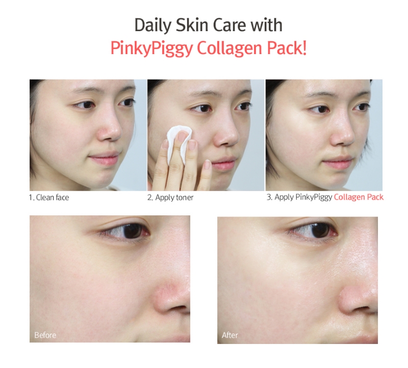 [AprilSkin] Pinky Piggy Collagen Pack